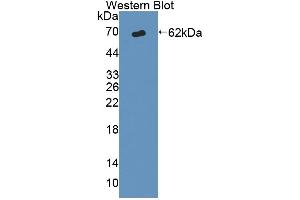 Figure. (ABCD1 Antikörper  (AA 102-386))