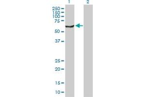 Western Blot analysis of NARS expression in transfected 293T cell line by NARS MaxPab polyclonal antibody. (NARS Antikörper  (AA 1-548))