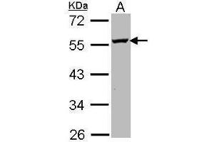 WB Image Sample (30 ug of whole cell lysate) A: Molt-4 , 10% SDS PAGE antibody diluted at 1:1000 (ODC1 Antikörper)