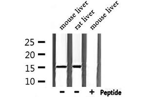 Western blot analysis of extracts from mouse liver,rat liver, using TAC1  Antibody. (TAC1 Antikörper  (N-Term))