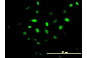 Immunofluorescence of purified MaxPab antibody to BCCIP on HeLa cell. (BCCIP Antikörper  (AA 1-322))