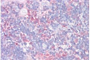 Anti-LGALS9 / Galectin-9 antibody IHC staining of human thymus. (Galectin 9 Antikörper  (AA 51-100))