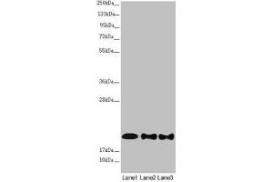 Western blot All lanes: NDUFB10 antibody at 2. (NDUFB1 Antikörper  (AA 1-172))