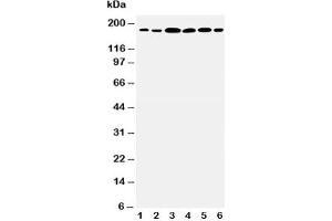 Western blot testing of Laminin gamma 1 antibody and Lane 1:  rat kidney;  2: rat lung;  3: U87;  4: SMMC-7721;  5: HeLa;  6: SKOV3 cell lysate