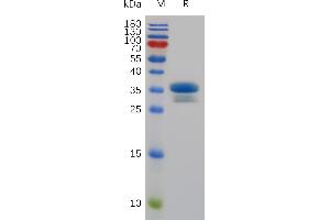 SDS-PAGE (SDS) image for Tumor Necrosis Factor Receptor Superfamily, Member 12A (TNFRSF12A) (AA 28-78) protein (Fc Tag) (ABIN7491071)