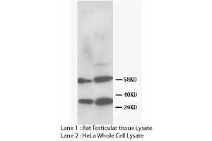 Image no. 2 for anti-DNA Repair Protein Homolog 1 (RAD51) (N-Term) antibody (ABIN1495062) (RAD51 Antikörper  (N-Term))