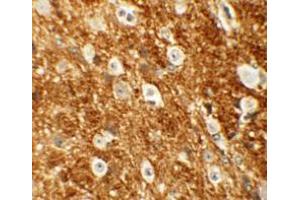 Immunohistochemistry (IHC) image for anti-rho-Associated, Coiled-Coil Containing Protein Kinase 2 (ROCK2) (Middle Region) antibody (ABIN1031072) (ROCK2 Antikörper  (Middle Region))