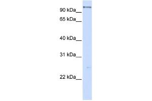WB Suggested Anti-DHX15 Antibody Titration:  0. (DHX15 Antikörper  (C-Term))