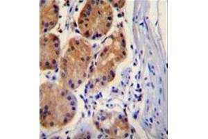 Formalin fixed, paraffin embedded human stomach tissuem stained with Catenin beta-1 Antibody (C-term) followed by peroxidase conjugation of the secondary antibody and DAB staining. (CTNNB1 Antikörper  (C-Term))