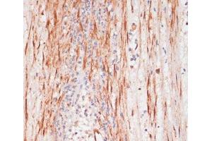 Immunohistochemistry of paraffin-embedded Human appendix using Phospho-PEA15(S104) Polyclonal Antibody at dilution of 1:100 (40x lens). (PEA15 Antikörper  (pSer104))