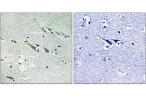 Immunohistochemistry (IHC) image for anti-V-Raf-1 Murine Leukemia Viral Oncogene Homolog 1 (RAF1) (AA 251-300) antibody (ABIN2889118) (RAF1 Antikörper  (AA 251-300))