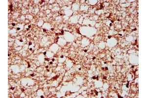 IHC image of ABIN7170618 diluted at 1:200 and staining in paraffin-embedded human brain tissue performed on a Leica BondTM system. (SF3B1 Antikörper  (AA 186-378))