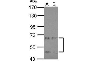 WB Image Sample (30 ug of whole cell lysate) A: NT2D1 B: IMR32 7. (CDKL3 Antikörper)