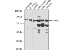 Western blot analysis of extracts of various cell lines, using CYP46 antibody (ABIN6130168, ABIN6139358, ABIN6139359 and ABIN6224675) at 1:1000 dilution. (CYP46A1 Antikörper  (AA 24-280))
