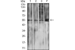 Western blot analysis using IghA1 mouse mAb against L1210 (1), THP-1 (2), HepG2 (3), and COS7 (4) cell lysate. (IGHA1 Antikörper  (AA 207-353))