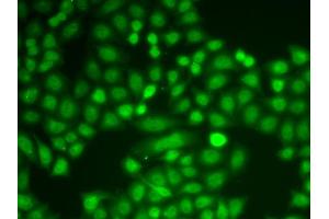 Immunofluorescence analysis of A549 cells using PYCARD antibody (ABIN4904914).