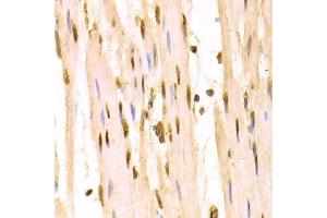 Immunohistochemistry of paraffin-embedded human esophagus using SFN Antibody. (14-3-3 sigma/SFN Antikörper  (AA 1-248))