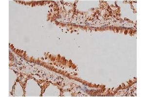 ABIN6267363 at 1/200 staining Rat lung tissue sections by IHC-P.
