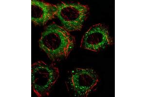 Immunofluorescence (IF) image for anti-Fatty Acid Desaturase 2 (FADS2) antibody (ABIN2928602) (FADS2 Antikörper)
