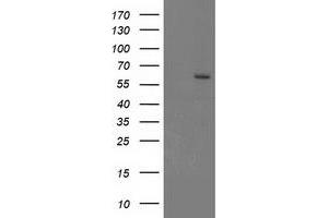Image no. 1 for anti-Cytochrome P450, Family 17, Subfamily A, Polypeptide 1 (CYP17A1) antibody (ABIN1497704) (CYP17A1 Antikörper)