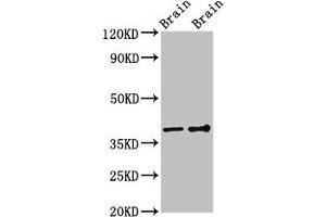 Western Blot Positive WB detected in: Rat brain tissue, Mouse brain tissue All lanes: GNB1 antibody at 3 μg/mL Secondary Goat polyclonal to rabbit IgG at 1/50000 dilution Predicted band size: 38, 37 kDa Observed band size: 38 kDa (GNB1 Antikörper  (AA 157-248))