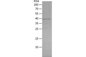 BRCA2 Protein (AA 1-160) (His-IF2DI Tag)