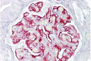 Immunohistochemistry (IHC) image for anti-Activin Receptor Type I (ACRV1) (N-Term) antibody (ABIN2782109)