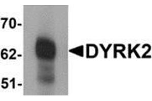 Western blot analysis of DYRK2 in 293 cell lysate with DYRK2 antibody at (A) 1 and (B) 2 μg/ml. (DYRK2 Antikörper  (C-Term))