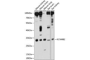 Western blot analysis of extracts of various cell lines, using KCNMB2 antibody (ABIN6129436, ABIN6142762, ABIN6142763 and ABIN6214468) at 1:1000 dilution. (KCNMB2 Antikörper  (AA 68-194))