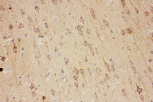 Anti-RTN3 antibody, IHC(P) IHC(P): Rat Brain Tissue
