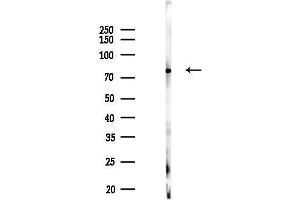 anti-Lipase, Hormone-Sensitive (LIPE) (pSer563) antibody