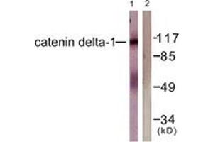 Western blot analysis of extracts from HuvEc cells, using Catenin-delta1 (Ab-228) Antibody. (CTNND1 Antikörper  (AA 201-250))