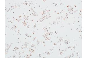 Immunocytochemistry (ICC) image for anti-Mediator Complex Subunit 12 (MED12) (AA 2127-2177) antibody (ABIN7453977) (Rekombinanter MED12 Antikörper  (AA 2127-2177))