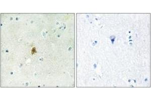 Immunohistochemistry (IHC) image for anti-TAF15 RNA Polymerase II, TATA Box Binding Protein (TBP)-Associated Factor, 68kDa (TAF15) (AA 351-400) antibody (ABIN1534044)