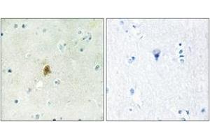 Immunohistochemistry analysis of paraffin-embedded human brain tissue, using TAF15 Antibody.