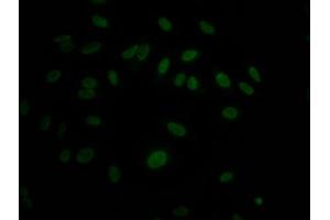 Immunofluorescence staining of Hela Cells with ABIN7127654 at 1:50, counter-stained with DAPI.
