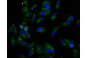 Immunofluorescence staining of Hela cells with ABIN7167082 at 1:166, counter-stained with DAPI. (REPS1 Antikörper  (AA 105-230))