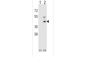 Western blot analysis of DCN using rabbit polyclonal DCN Antibody using 293 cell lysates (2 ug/lane) either nontransfected (Lane 1) or transiently transfected (Lane 2) with the DCN gene. (Decorin Antikörper  (AA 122-150))