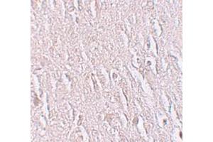 Immunohistochemistry (IHC) image for anti-Zinc Finger and BTB Domain Containing 5 (ZBTB5) (C-Term) antibody (ABIN1030813) (ZBTB5 Antikörper  (C-Term))