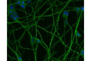 Immunofluorescent staining of differentiated SH-SY5Y cells (right). (SNRPN Antikörper  (AA 14-174))