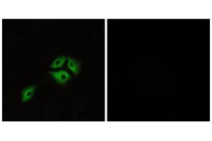 Immunofluorescence analysis of A549 cells, using NMBR antibody. (NMBR Antikörper  (Internal Region))