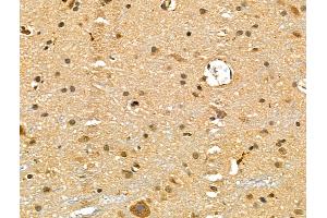 ABIN6258459 and ABIN6275835 at 1/100 staining Rat brain tissue by IHC-P.
