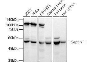 Western blot analysis of extracts of various cell lines, using Septin 11 antibody (ABIN6129126, ABIN6147548, ABIN6147550 and ABIN6215781) at 1:4890 dilution. (Septin 11 Antikörper  (AA 1-120))