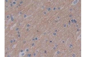 Detection of VSNL1 in Human Cerebrum Tissue using Polyclonal Antibody to Visinin Like Protein 1 (VSNL1) (VSNL1 Antikörper  (AA 39-184))