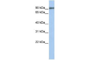 WB Suggested Anti-GTSE1 Antibody Titration:  0. (GTSE1 Antikörper  (Middle Region))