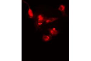 ABIN6272361 staining Hela by IF/ICC. (NFRKB Antikörper)