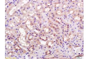 Formalin-fixed and paraffin embedded rat kidney labeled with Rabbit Anti K Cadherin Polyclonal Antibody, Unconjugated (ABIN715286) at 1:200 followed by conjugation to the secondary antibody and DAB staining