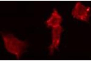 ABIN6272409 staining MCF7 by IF/ICC. (AGFG2 Antikörper  (Internal Region))