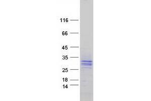 Validation with Western Blot