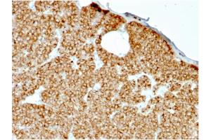 Formalin-fixed, paraffin-embedded human Parathyroid stained with PTH Mouse Recombinant Monoclonal Antibody (rPTH/911). (Rekombinanter PTH Antikörper  (AA 1-34))